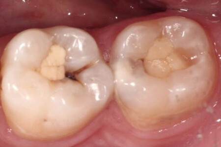 Примеры работ QR Dental