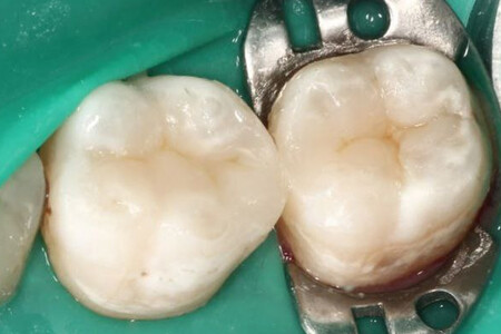 Примеры работ QR Dental