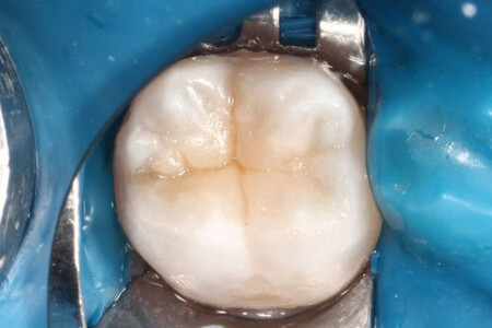 Примеры работ QR Dental