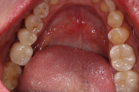 Примеры работ QR Dental