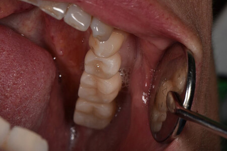 Примеры работ QR Dental