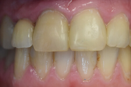 Примеры работ QR Dental