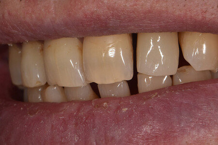 Примеры работ QR Dental