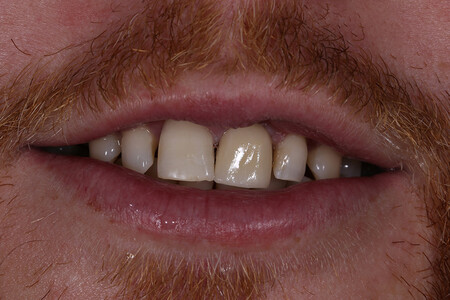 Примеры работ QR Dental