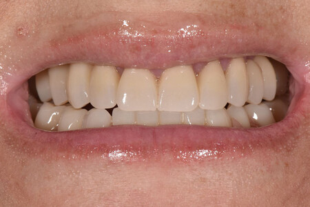 Примеры работ QR Dental