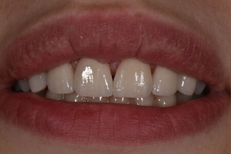 Примеры работ QR Dental