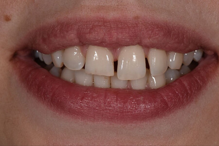 Примеры работ QR Dental