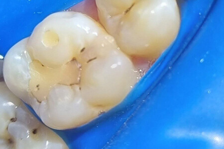 Примеры работ QR Dental