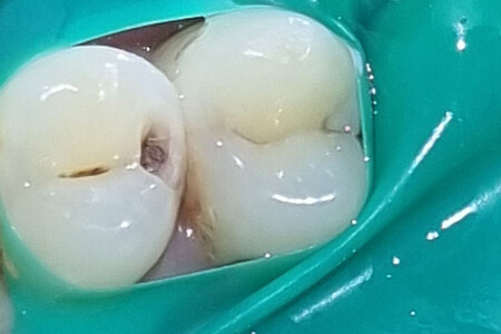 Примеры работ QR Dental