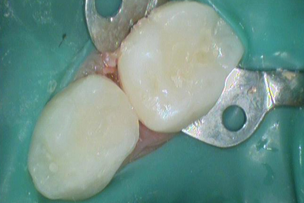 Примеры работ QR Dental