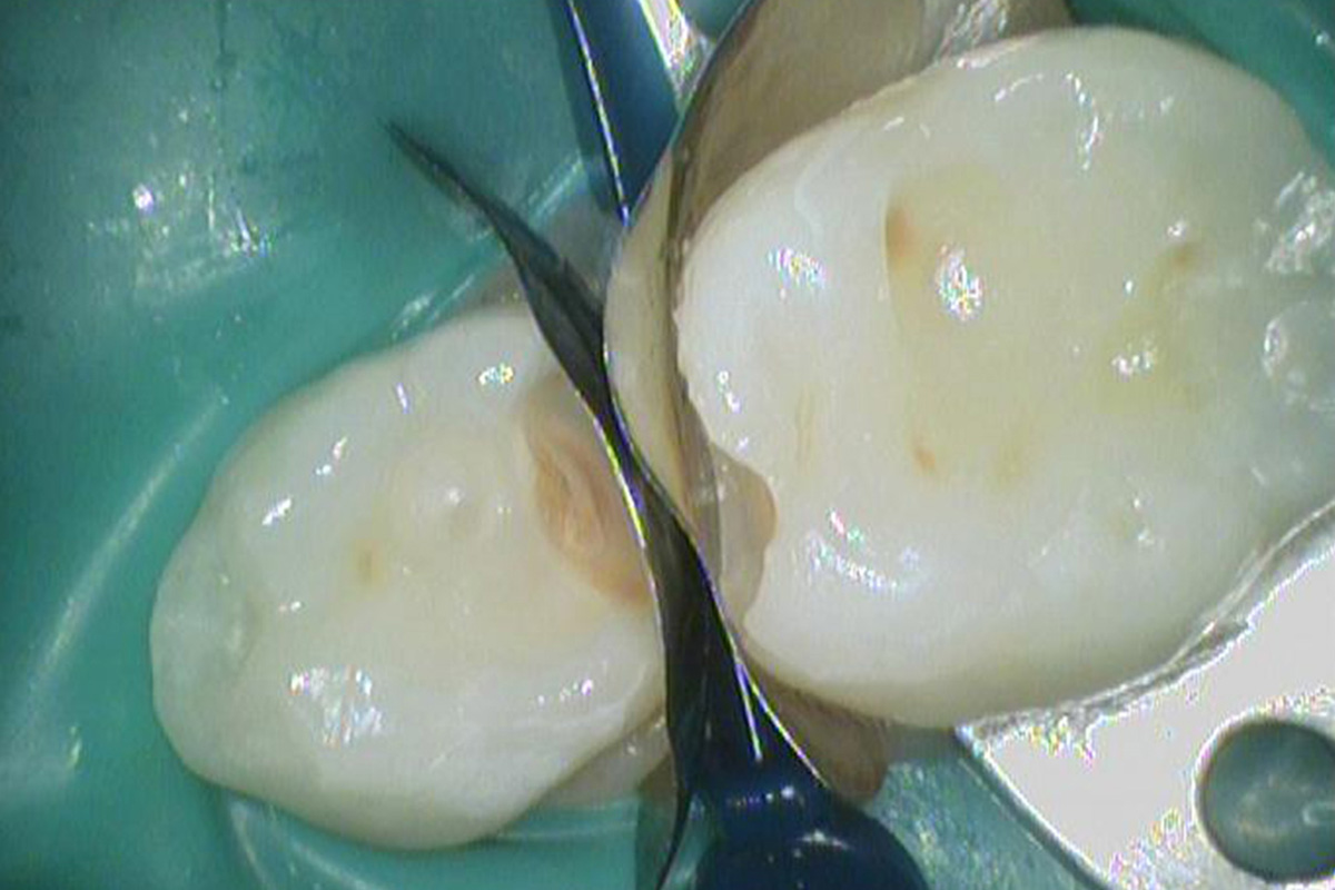 Примеры работ QR Dental