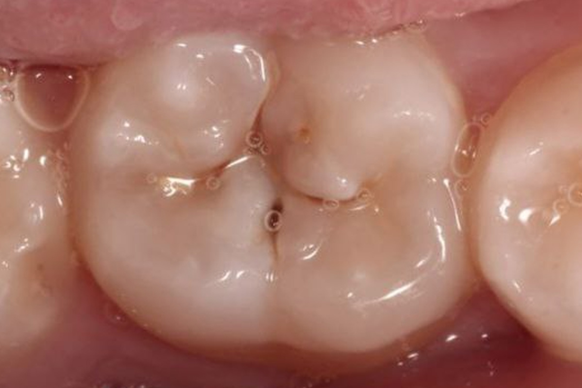 Примеры работ QR Dental