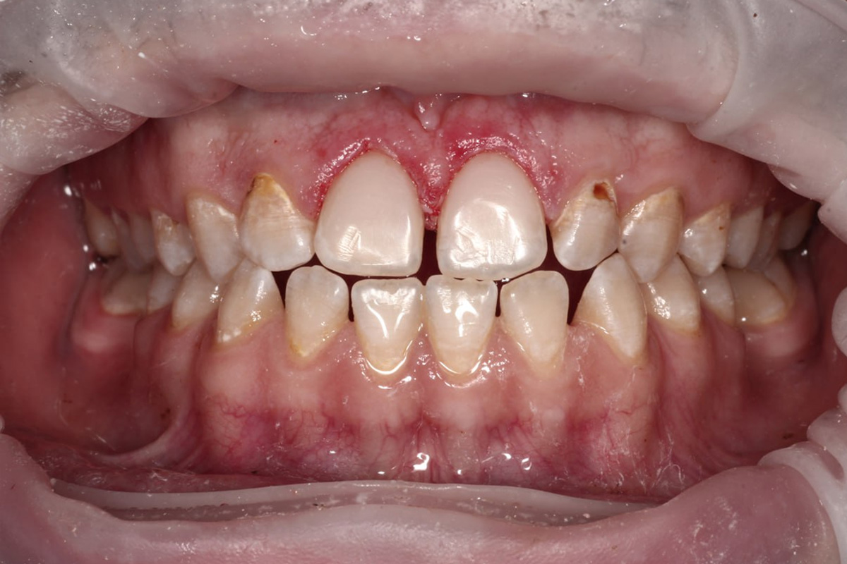 Примеры работ QR Dental