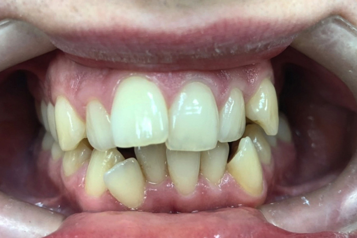 Примеры работ QR Dental