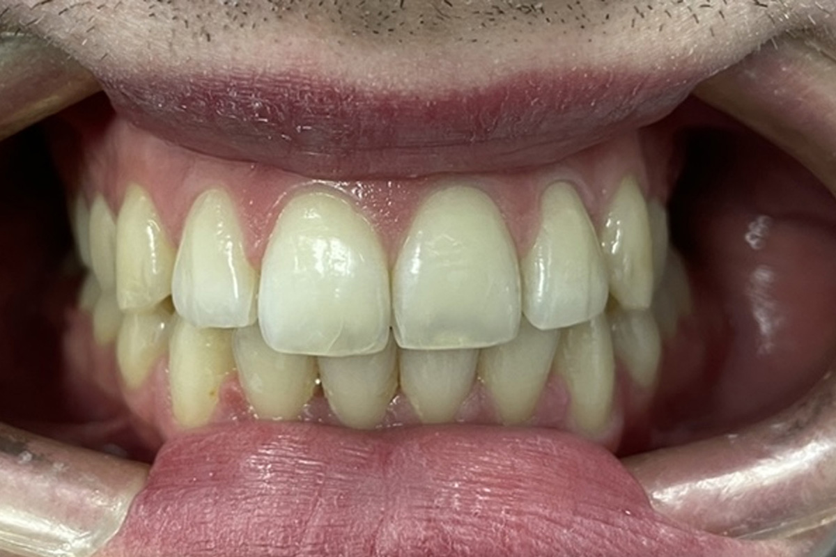 Примеры работ QR Dental