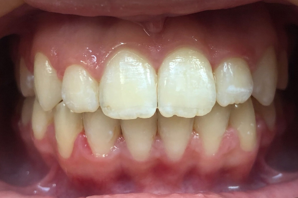 Примеры работ QR Dental