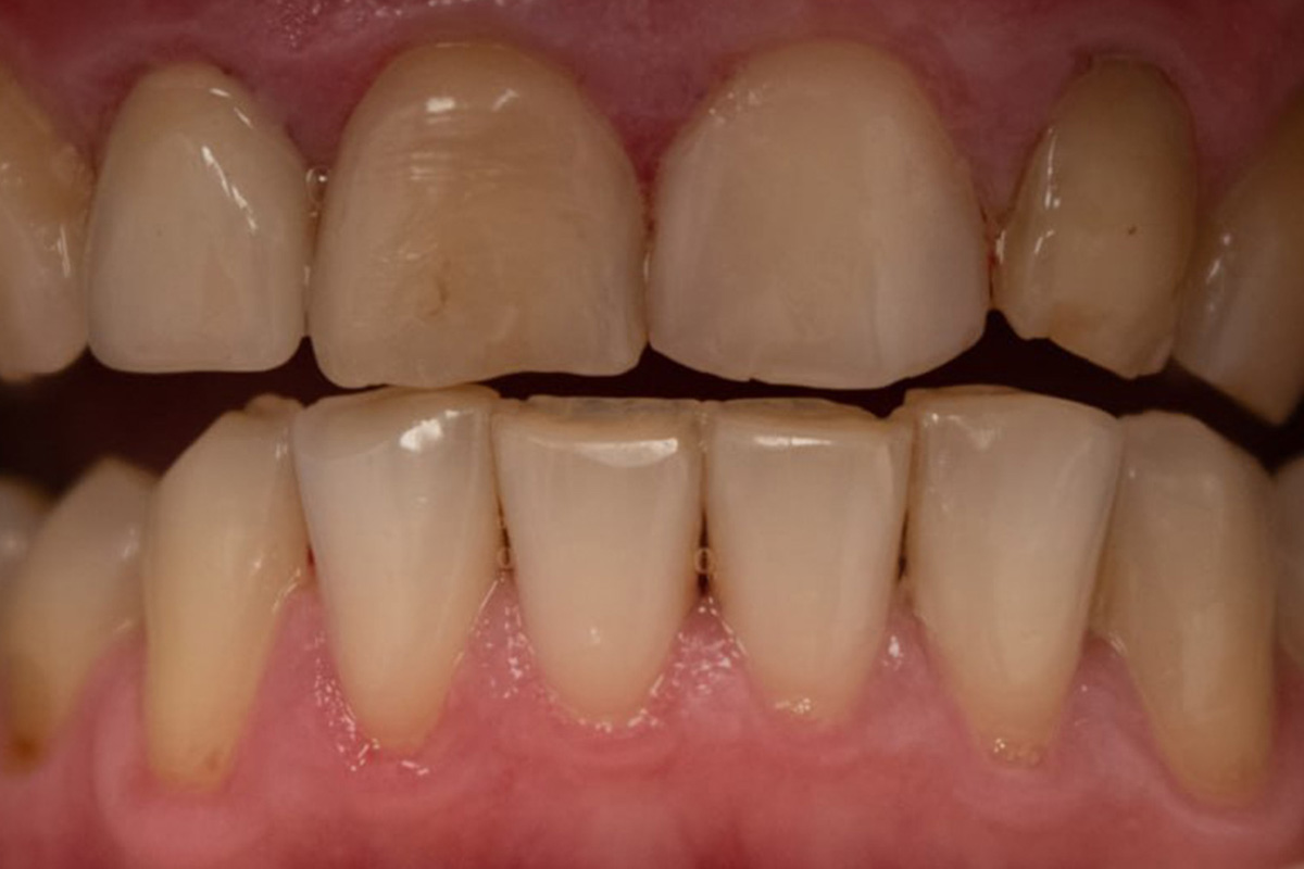 Примеры работ QR Dental