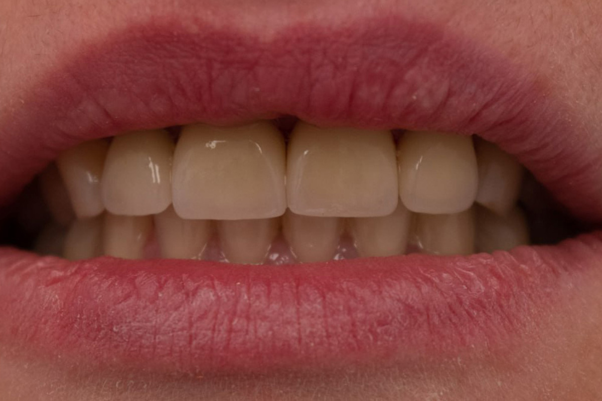 Примеры работ QR Dental