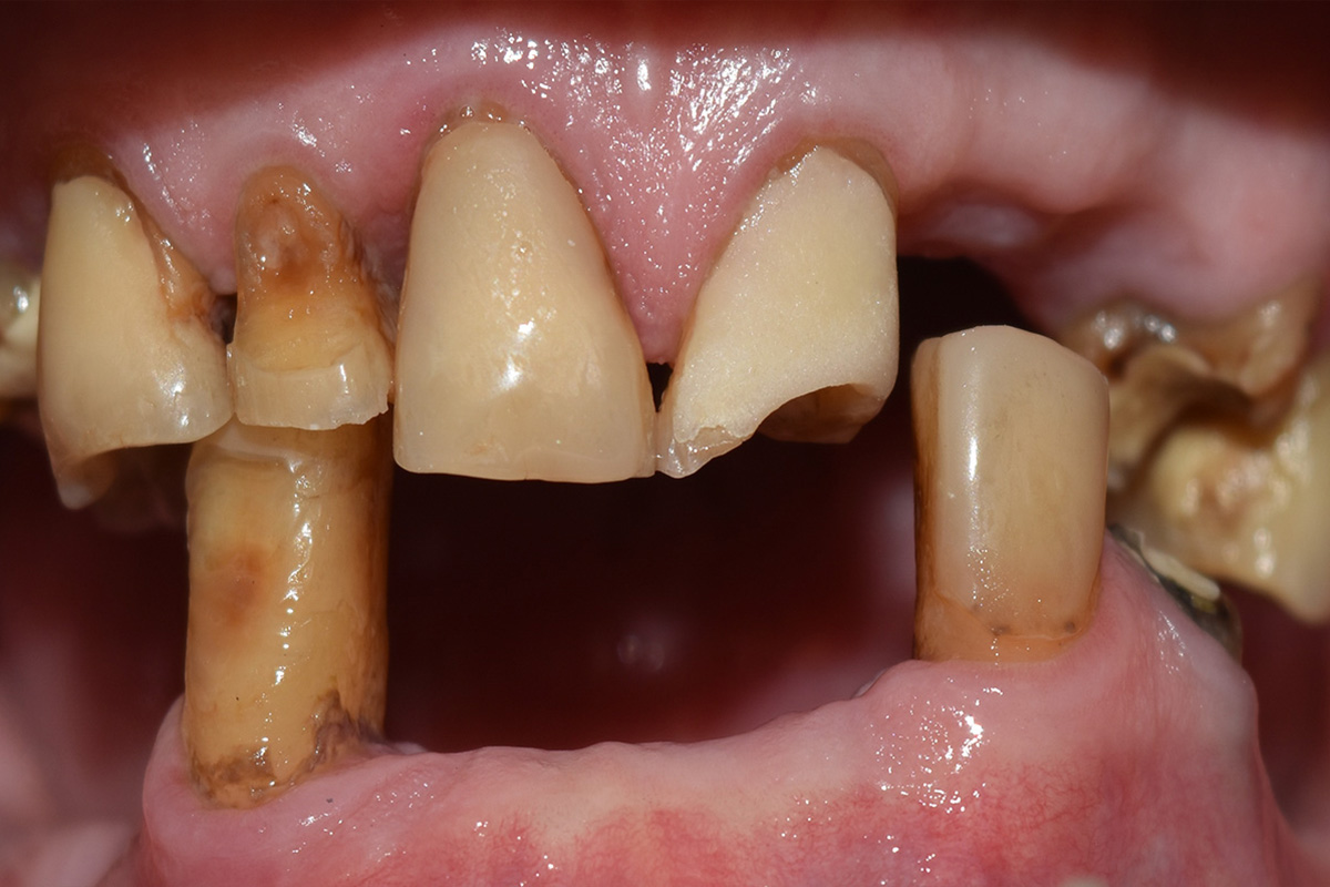 Примеры работ QR Dental