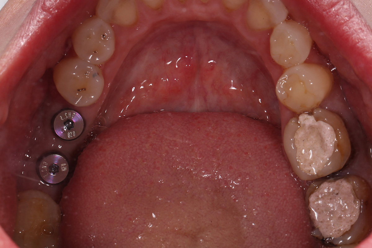 Примеры работ QR Dental