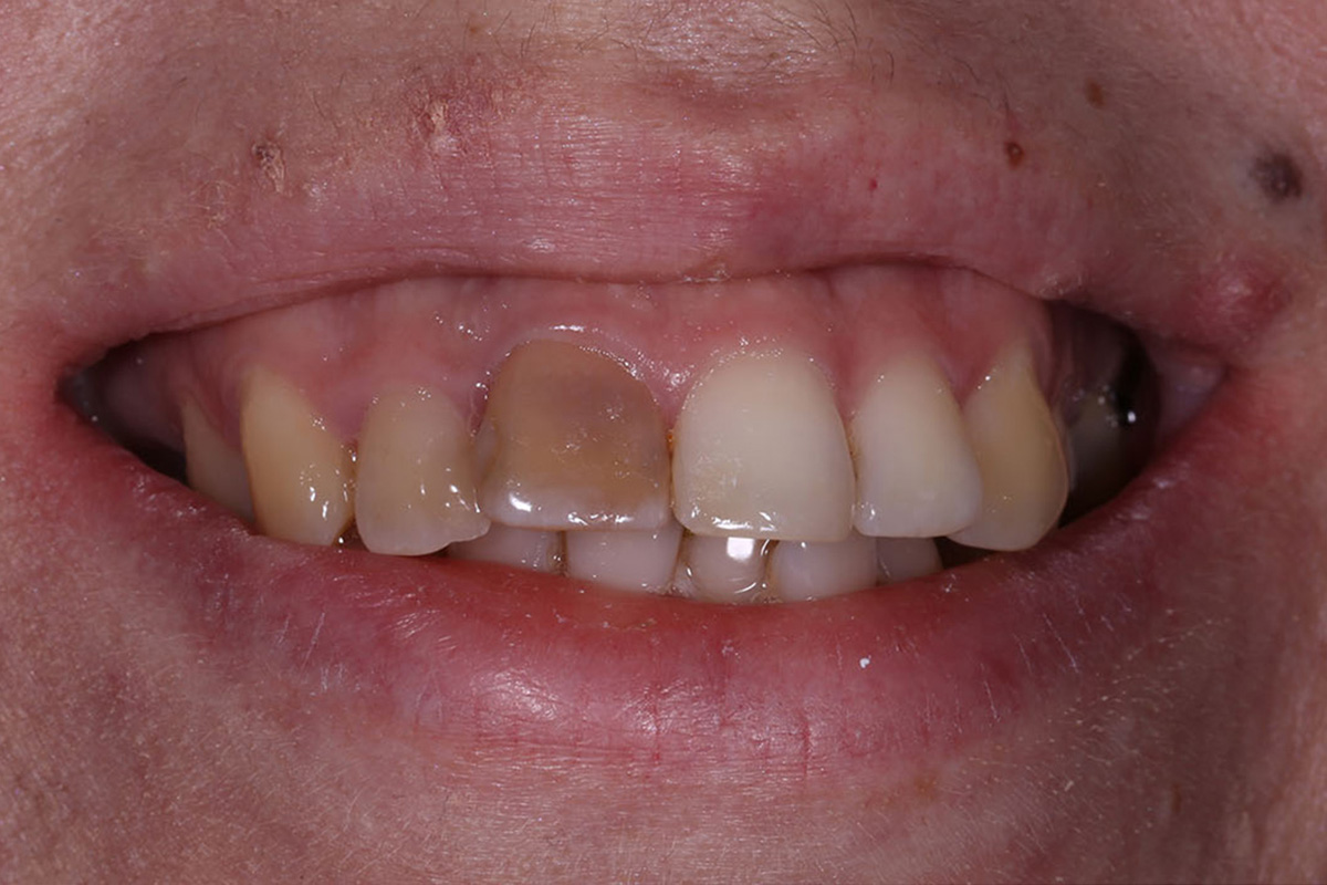 Примеры работ QR Dental