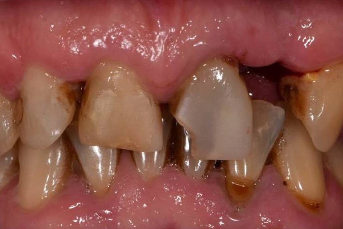 Примеры работ QR Dental