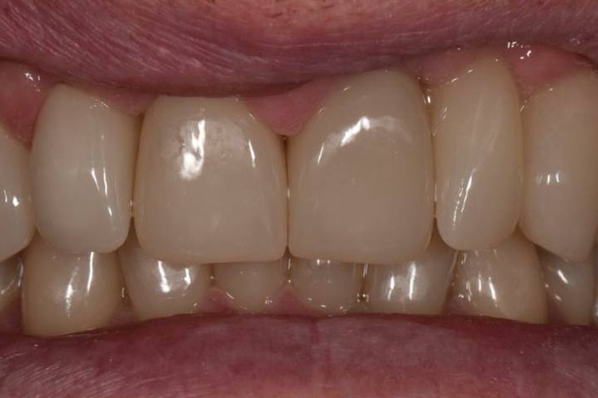 Примеры работ QR Dental