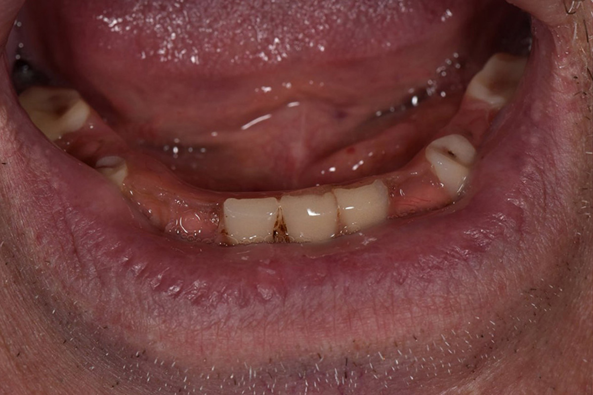 Примеры работ QR Dental