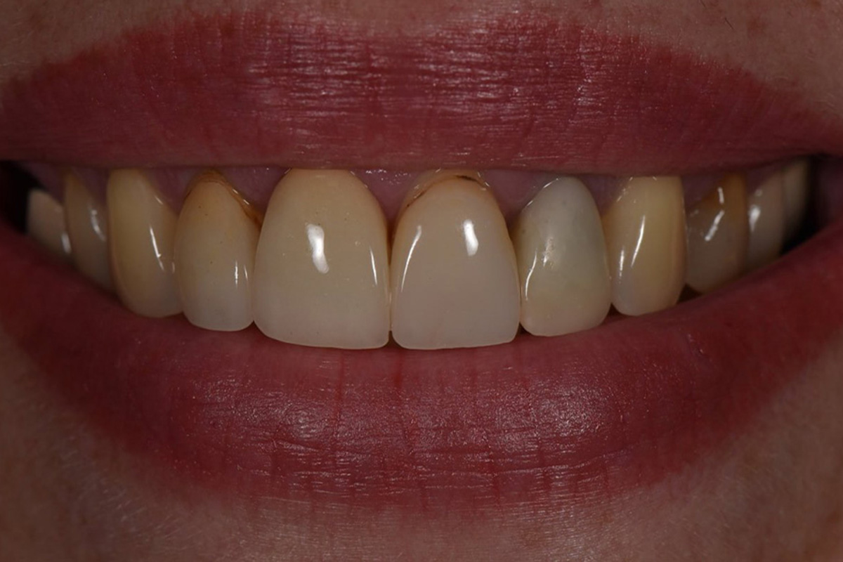 Примеры работ QR Dental