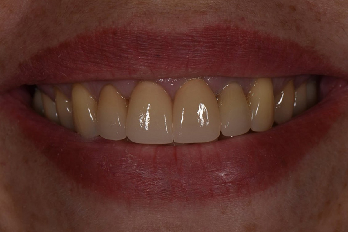 Примеры работ QR Dental