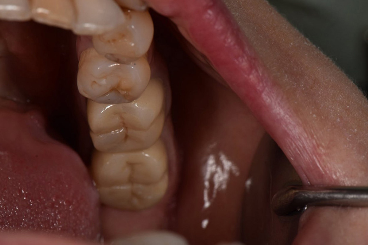 Примеры работ QR Dental