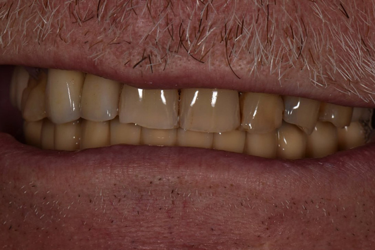 Примеры работ QR Dental