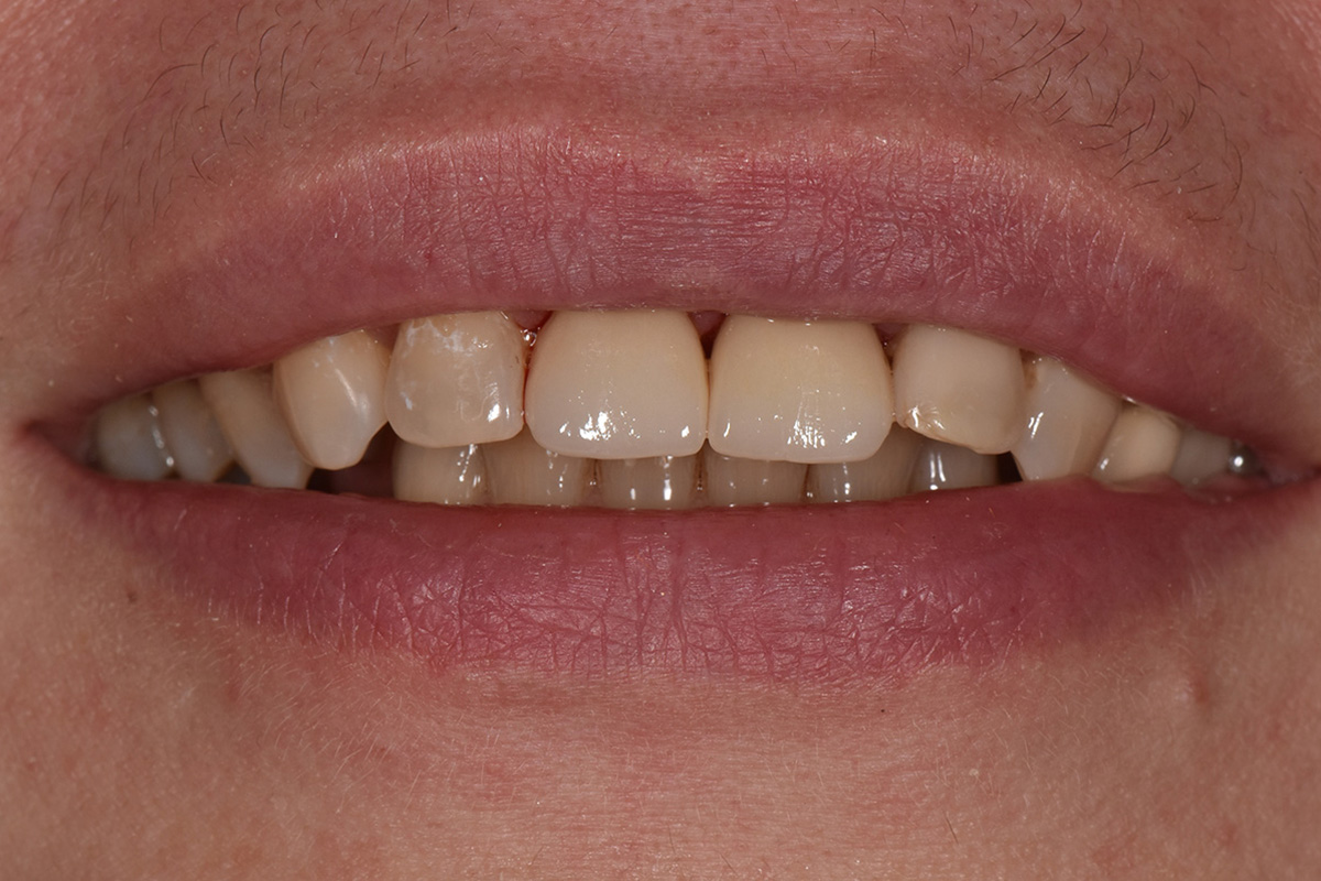 Примеры работ QR Dental