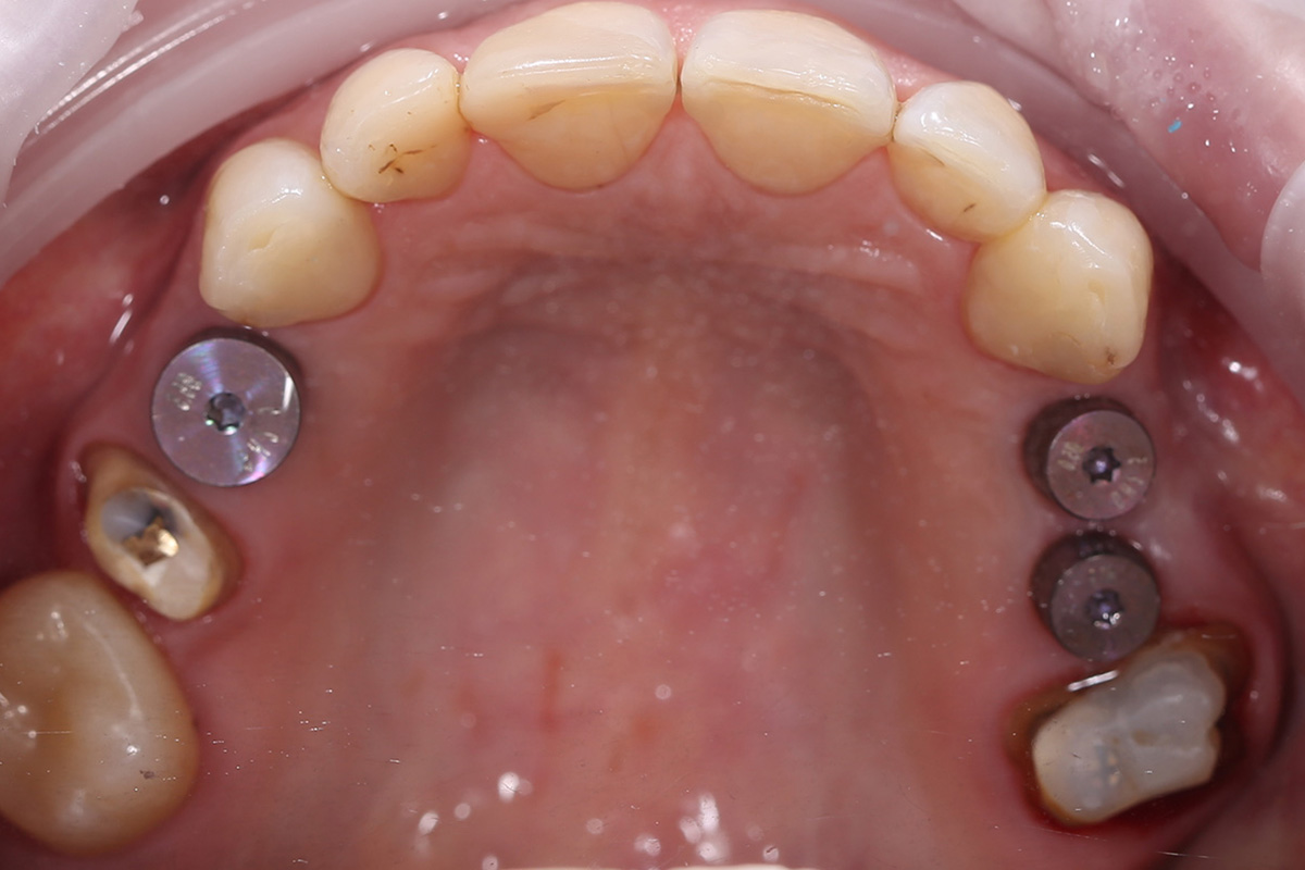 Примеры работ QR Dental