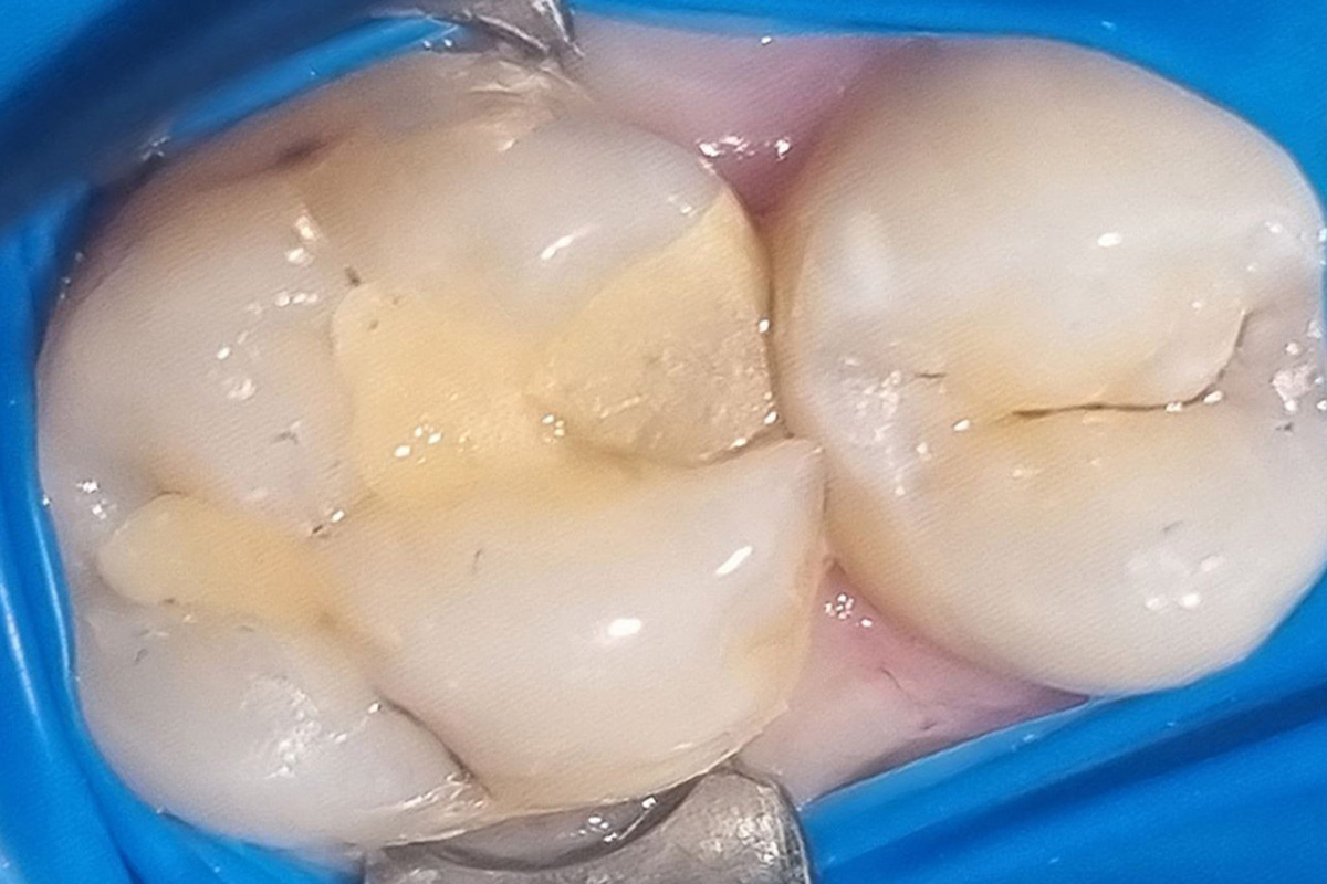 Примеры работ QR Dental