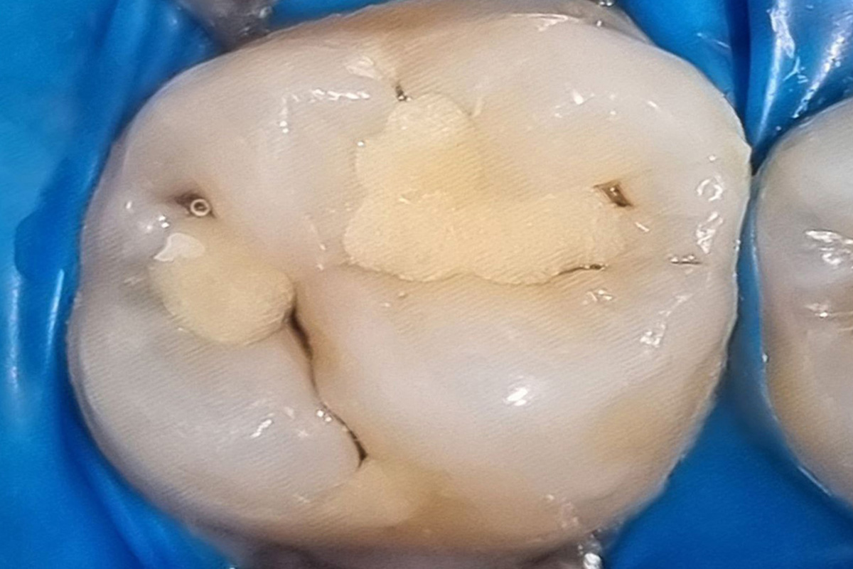 Примеры работ QR Dental