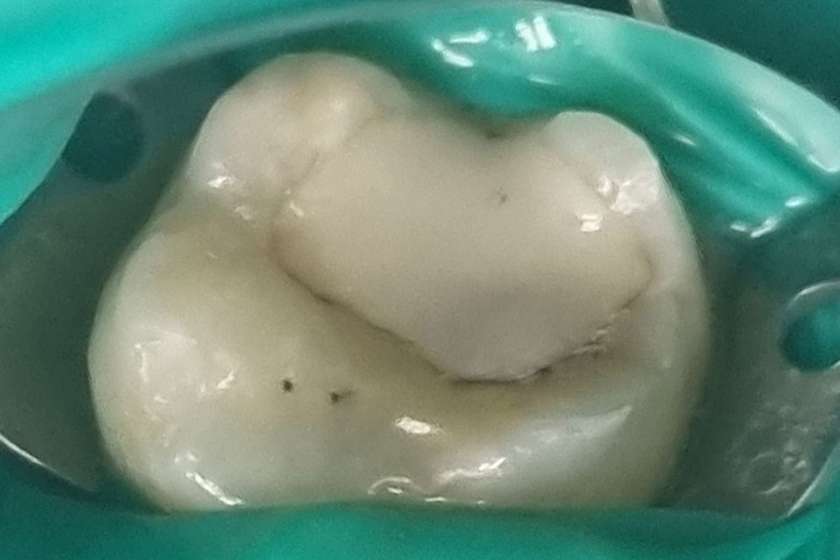 Примеры работ QR Dental