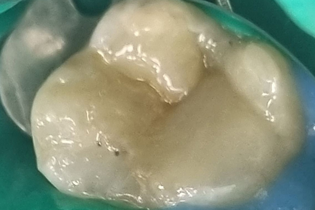 Примеры работ QR Dental