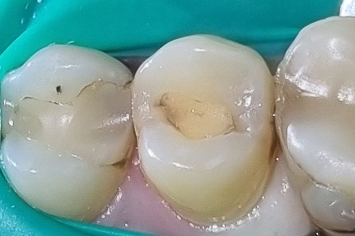 Примеры работ QR Dental