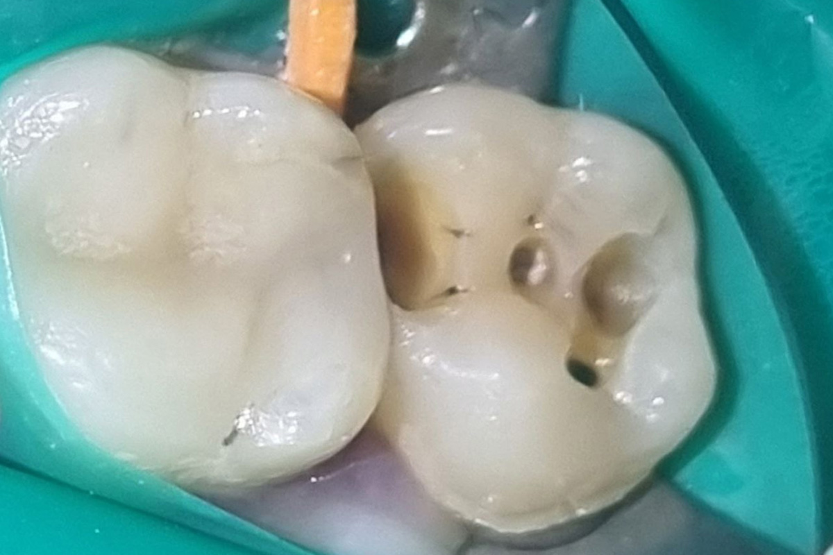 Примеры работ QR Dental