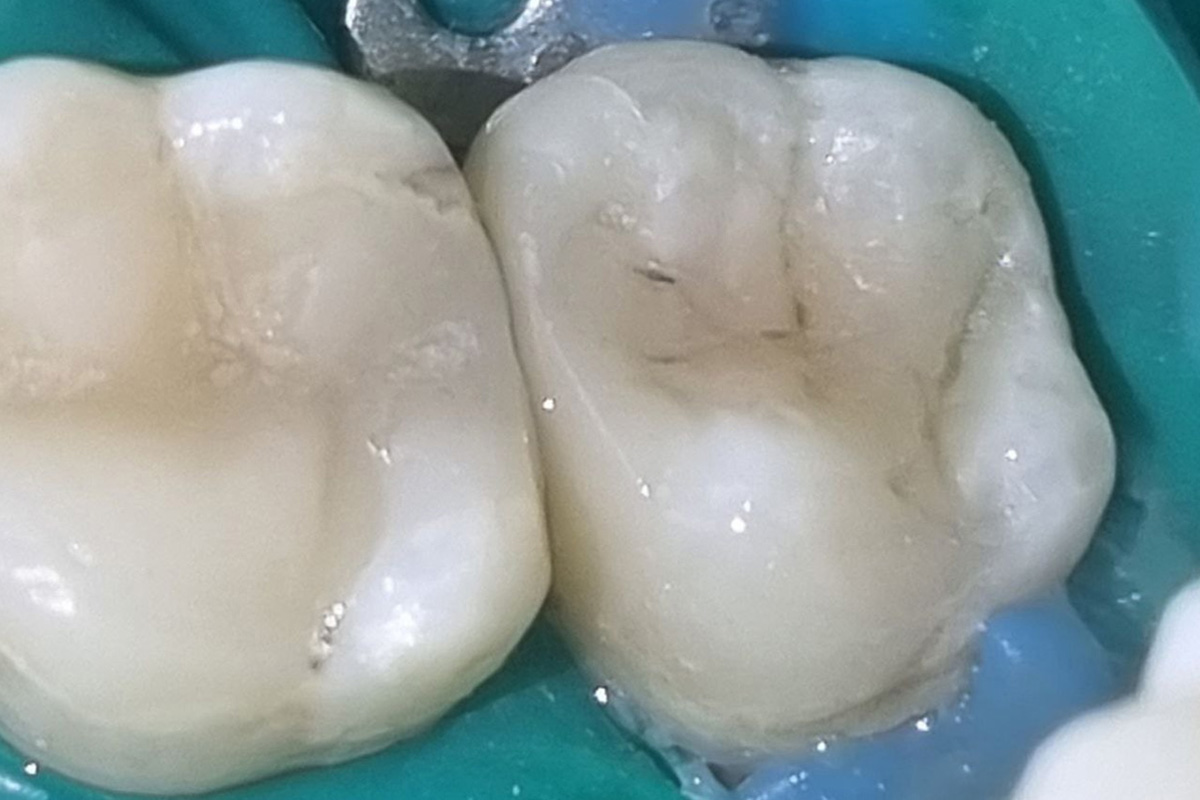 Примеры работ QR Dental