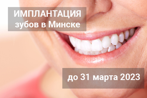 Консультация по имплантации