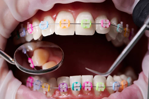 Ортодонтия и возраст