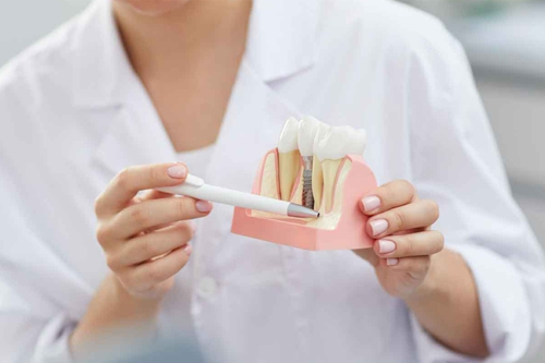 Этапы протезирования