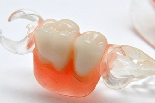 Условно-съемные протезы