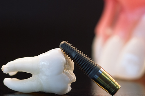 Методы имплантации