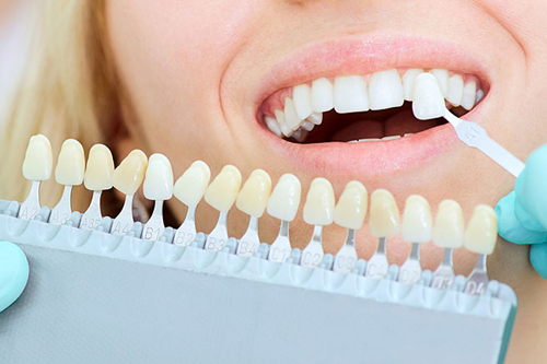 Все о протезировании