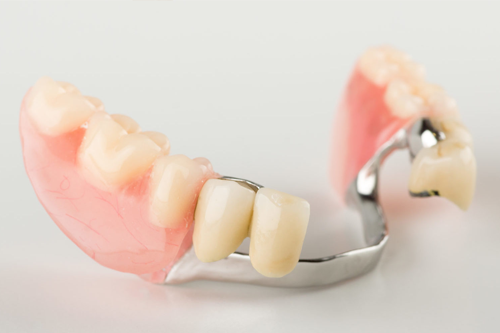 Бюгельные протезы