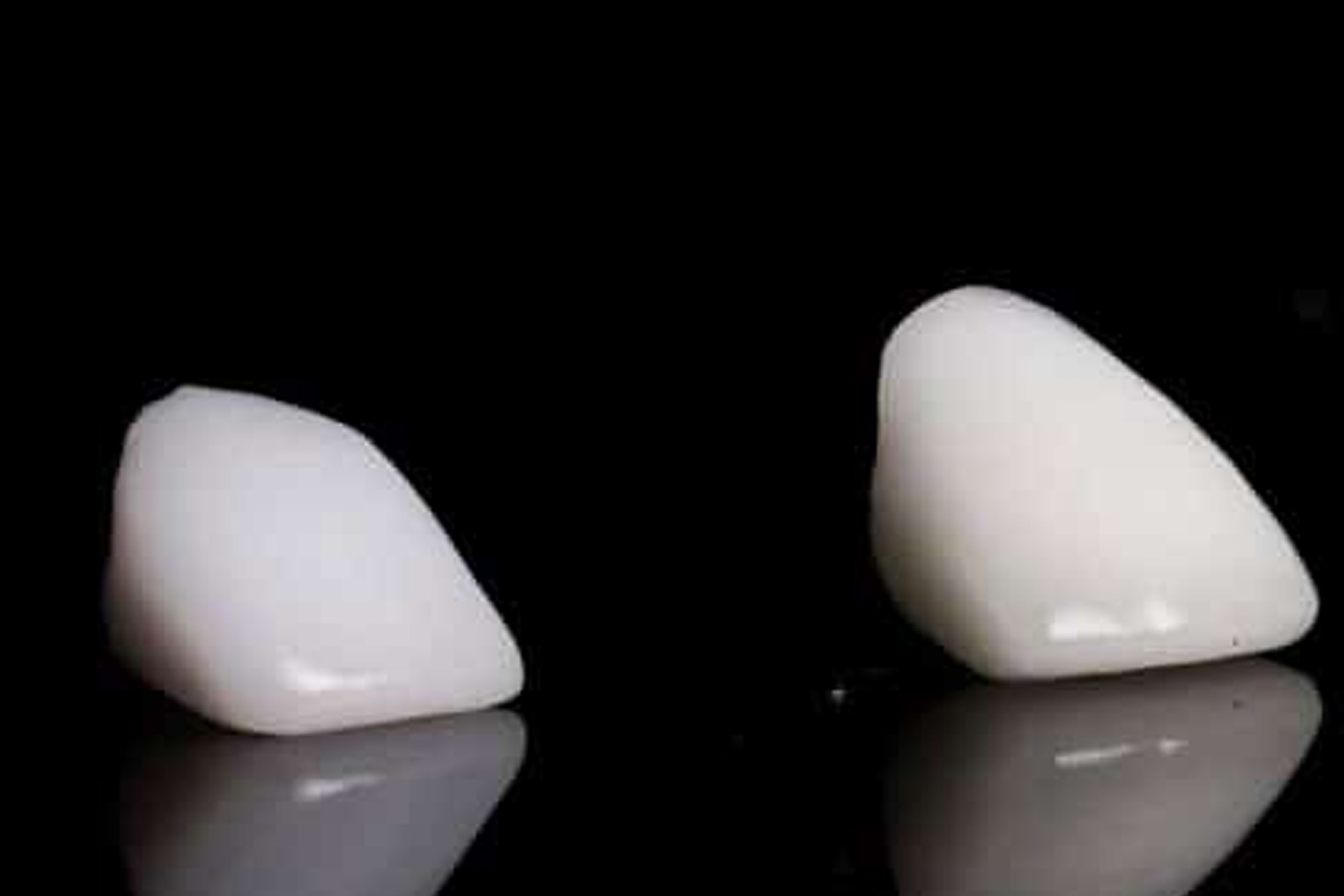 Коронка из циркония