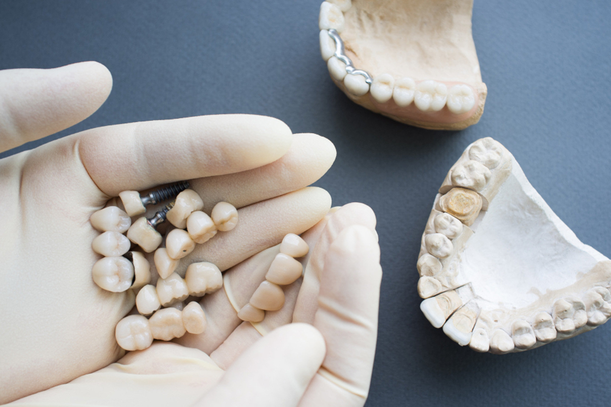 Установка коронки